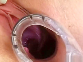 Blond junior nurse Kristyna inserts speculum in her pussy