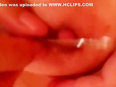 Electricity is poured into a safety pin and an urethra 