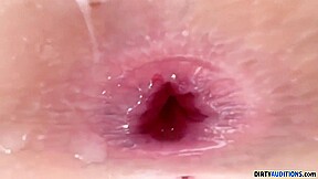 Mila Taylor In Milas Outdoor Anal