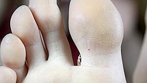 Pests Epic sfx