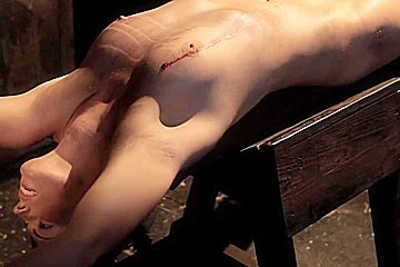 The History Of Pain