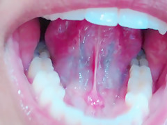 Tongue, Tonsils, and Throat Examination