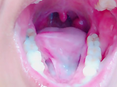 Tongue, Tonsils, and Throat Examination