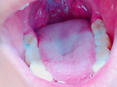 Tongue, Tonsils, and Throat Examination
