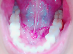 Tongue, Tonsils, and Throat Examination