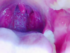 Tongue, Tonsils, and Throat Examination