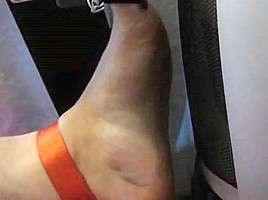 Tortured foot roasted by heating after bastinado and falaka