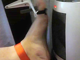 Tortured foot roasted by heating after bastinado and falaka