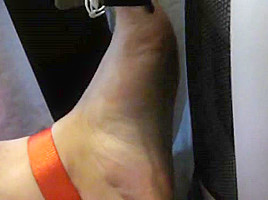 Tortured foot roasted by heating after bastinado and falaka