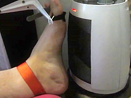 Tortured foot roasted by heating after bastinado and falaka