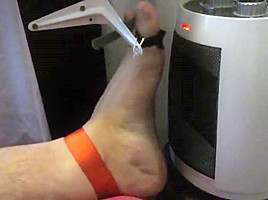 Tortured foot roasted by heating after bastinado and falaka