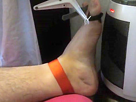 Tortured foot roasted by heating after bastinado and falaka