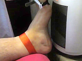 Tortured foot roasted by heating after bastinado and falaka