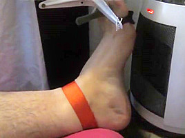 Tortured foot roasted by heating after bastinado and falaka