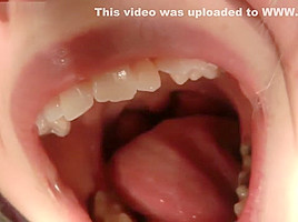 cag lilly's uvula
