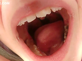 cag lilly's uvula