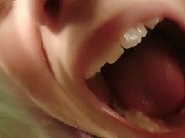 cag lilly's uvula