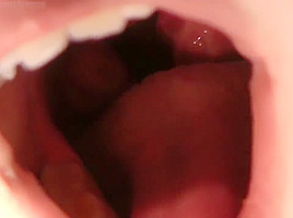 cag lilly's uvula