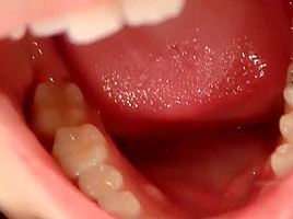 cag lilly's uvula