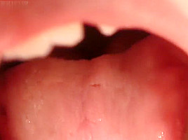 cag lilly's uvula