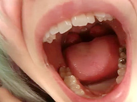cag lilly's uvula