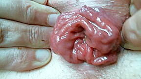 olibrius71 rosebud, anal toy prolapse